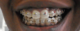 AstraDental